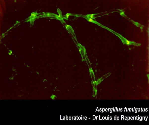 Aspergillus fumigatus-Laboratoire de Repentigny 10